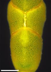 Veronica annulata. Close-up of leaves with obscure nodal joint. Scale = 1 mm.
 Image: W.M. Malcolm © Te Papa CC-BY-NC 3.0 NZ